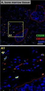 Mouse IgG (H+L) Highly Cross-Adsorbed Secondary Antibody in Immunohistochemistry (Paraffin) (IHC (P))