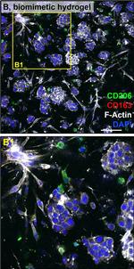 Mouse IgG (H+L) Highly Cross-Adsorbed Secondary Antibody in Immunohistochemistry (Paraffin) (IHC (P))