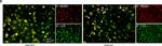 Rabbit IgG (H+L) Highly Cross-Adsorbed Secondary Antibody in Immunocytochemistry (ICC/IF)