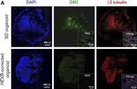 Mouse IgG (H+L) Highly Cross-Adsorbed Secondary Antibody in Immunohistochemistry (Frozen) (IHC (F))