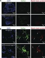 Mouse IgM (Heavy chain) Cross-Adsorbed Secondary Antibody in Immunohistochemistry (Frozen) (IHC (F))