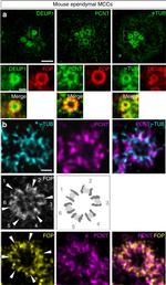 Mouse IgG2b Cross-Adsorbed Secondary Antibody in Immunocytochemistry (ICC/IF)