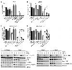 Phospho-AKT1 (Ser473) Antibody in Western Blot (WB)