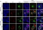 Rabbit IgG (H+L) Highly Cross-Adsorbed Secondary Antibody in Immunocytochemistry (ICC/IF)