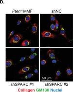 Rabbit IgG (H+L) Cross-Adsorbed Secondary Antibody in Immunocytochemistry (ICC/IF)