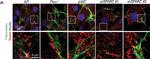 Rabbit IgG (H+L) Cross-Adsorbed Secondary Antibody in Immunocytochemistry (ICC/IF)