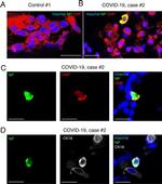 Rabbit IgG (H+L) Highly Cross-Adsorbed Secondary Antibody in Immunocytochemistry (ICC/IF)