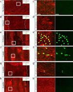 Goat IgG (H+L) Cross-Adsorbed Secondary Antibody in Immunocytochemistry (ICC/IF)