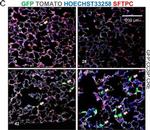 Rabbit IgG (H+L) Highly Cross-Adsorbed Secondary Antibody in Immunohistochemistry (Paraffin) (IHC (P))