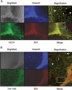 Rabbit IgG (H+L) Cross-Adsorbed Secondary Antibody in Immunocytochemistry (ICC/IF)