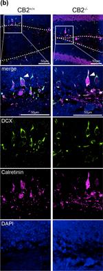 Guinea Pig IgG (H+L) Highly Cross-Adsorbed Secondary Antibody in Immunohistochemistry (IHC)