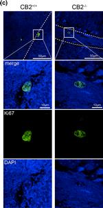 Rabbit IgG (H+L) Cross-Adsorbed Secondary Antibody in Immunohistochemistry (IHC)