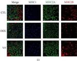 Mouse IgM (Heavy chain) Cross-Adsorbed Secondary Antibody in Immunohistochemistry (IHC)