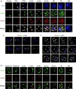 Rabbit IgG (H+L) Highly Cross-Adsorbed Secondary Antibody in Immunohistochemistry (IHC)