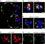 Rabbit IgG (H+L) Highly Cross-Adsorbed Secondary Antibody in Immunohistochemistry (IHC)