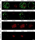 Rabbit IgG (H+L) Highly Cross-Adsorbed Secondary Antibody in Immunohistochemistry (IHC)