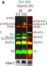 Rabbit IgG (H+L) Cross-Adsorbed Secondary Antibody in Western Blot (WB)