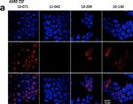 Human IgG (H+L) Cross-Adsorbed Secondary Antibody in Immunocytochemistry (ICC/IF)