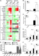 TSLP Antibody in ELISA (ELISA)