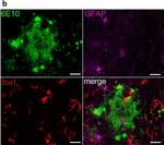 Rabbit IgG (H+L) Highly Cross-Adsorbed Secondary Antibody in Immunohistochemistry (IHC)