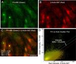 Mouse IgG (H+L) Highly Cross-Adsorbed Secondary Antibody in Immunocytochemistry (ICC/IF)