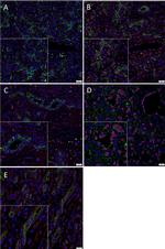 Mouse IgG (H+L) Highly Cross-Adsorbed Secondary Antibody in Immunohistochemistry (Paraffin) (IHC (P))