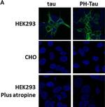 Mouse IgG (H+L) Highly Cross-Adsorbed Secondary Antibody in Immunocytochemistry (ICC/IF)