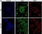 Rabbit IgG (H+L) Highly Cross-Adsorbed Secondary Antibody in Immunocytochemistry (ICC/IF)