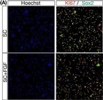 Rabbit IgG (H+L) Highly Cross-Adsorbed Secondary Antibody in Immunocytochemistry (ICC/IF)