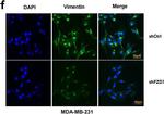 Rabbit IgG (H+L) Highly Cross-Adsorbed Secondary Antibody in Immunocytochemistry (ICC/IF)