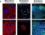 Rabbit IgG (H+L) Highly Cross-Adsorbed Secondary Antibody in Immunocytochemistry (ICC/IF)