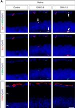 Rat IgG (H+L) Highly Cross-Adsorbed Secondary Antibody in Immunohistochemistry (PFA fixed) (IHC (PFA))