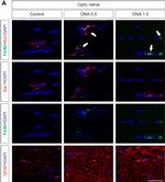 Rat IgG (H+L) Highly Cross-Adsorbed Secondary Antibody in Immunohistochemistry (PFA fixed) (IHC (PFA))