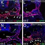 Mouse IgG (H+L) Highly Cross-Adsorbed Secondary Antibody in Immunohistochemistry (Paraffin) (IHC (P))