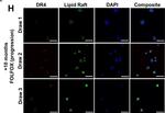 Mouse IgG (H+L) Cross-Adsorbed Secondary Antibody in Immunocytochemistry (ICC/IF)