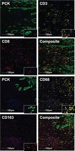 Mouse IgG (H+L) Cross-Adsorbed Secondary Antibody in Immunohistochemistry (IHC)