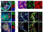 Goat IgG (H+L) Cross-Adsorbed Secondary Antibody in Immunohistochemistry (IHC)