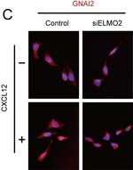 Mouse IgG (H+L) Highly Cross-Adsorbed Secondary Antibody in Immunocytochemistry (ICC/IF)