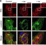 Rabbit IgG (H+L) Cross-Adsorbed Secondary Antibody in Immunohistochemistry (IHC)