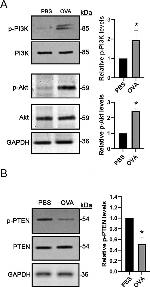 Rabbit IgG (H+L) Cross-Adsorbed Secondary Antibody in Western Blot (WB)