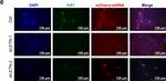 Rabbit IgG (H+L) Cross-Adsorbed Secondary Antibody in Immunocytochemistry (ICC/IF)