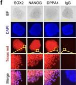 Mouse IgG (H+L) Cross-Adsorbed Secondary Antibody in Immunocytochemistry (ICC/IF)