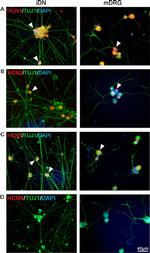 Mouse IgG (H+L) Highly Cross-Adsorbed Secondary Antibody in Immunocytochemistry (ICC/IF)