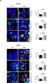 Rabbit IgG (H+L) Highly Cross-Adsorbed Secondary Antibody in Immunocytochemistry (ICC/IF)