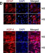 Mouse IgG (H+L) Highly Cross-Adsorbed Secondary Antibody in Immunohistochemistry (Frozen) (IHC (F))