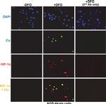 Rabbit IgG (H+L) Highly Cross-Adsorbed Secondary Antibody in Immunocytochemistry (ICC/IF)