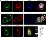 Mouse IgG (H+L) Highly Cross-Adsorbed Secondary Antibody in Immunocytochemistry (ICC/IF)