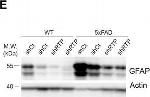 Rabbit IgG (H+L) Secondary Antibody in Western Blot (WB)