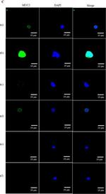 Rabbit IgG (H+L) Secondary Antibody in Immunocytochemistry (ICC/IF)