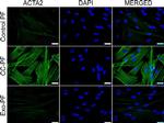 Rabbit IgG (H+L) Cross-Adsorbed Secondary Antibody in Immunocytochemistry (ICC/IF)